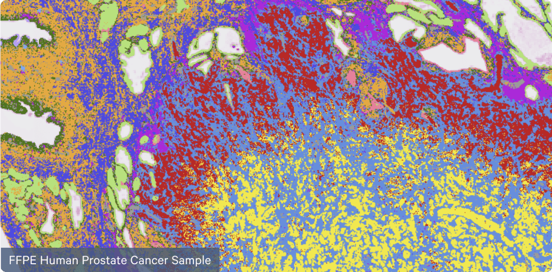 Hd Products Visium Hd Spatial Gene Expression 10x Genomics Hd Products Visium Hd Spatial Gene Expression 10x Genomics
